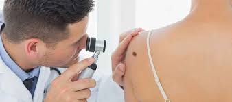 Exposição ao sol e câncer de pele: saiba como prevenir, diagnosticar e tratar